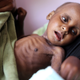 A malnourished child is seen at a therapeutic feeding centre at al-Sabyeen hospital in Sanaa April 15, 2013. (Reuters/Mohammed al-Sayaghi)